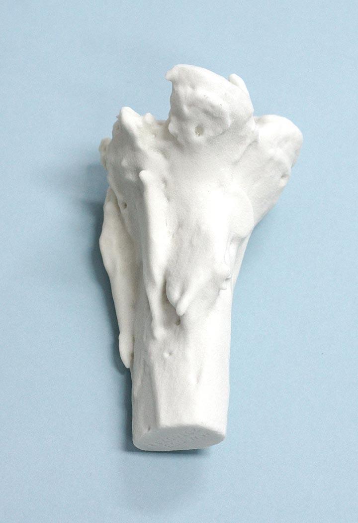 Przykładowe implanty Chirurgia 3D