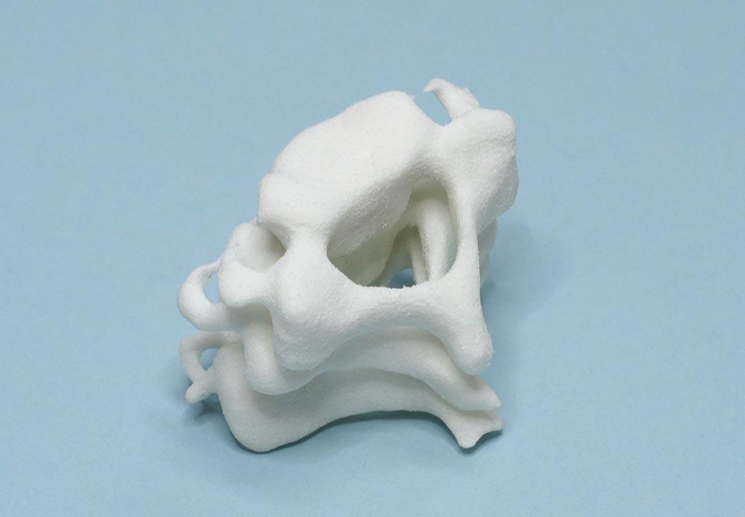 Przykładowe implanty Chirurgia 3D