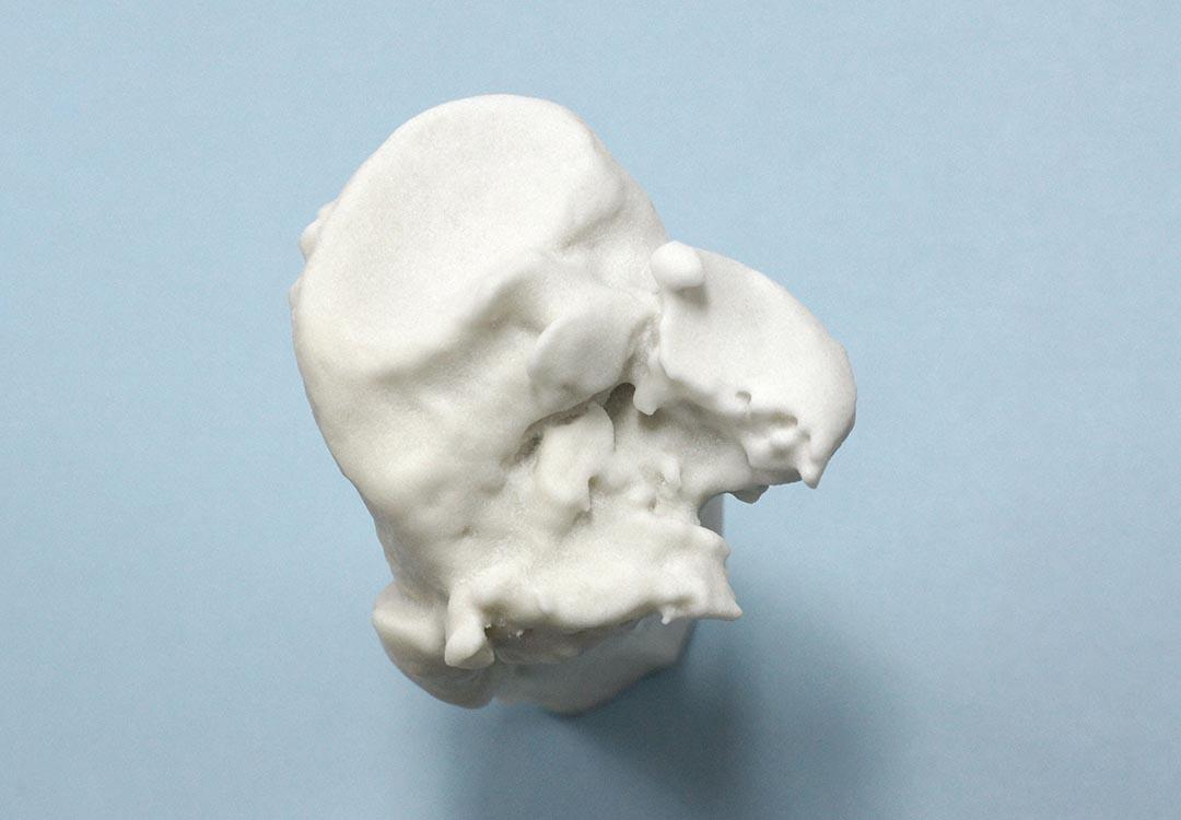 Przykładowe implanty Chirurgia 3D