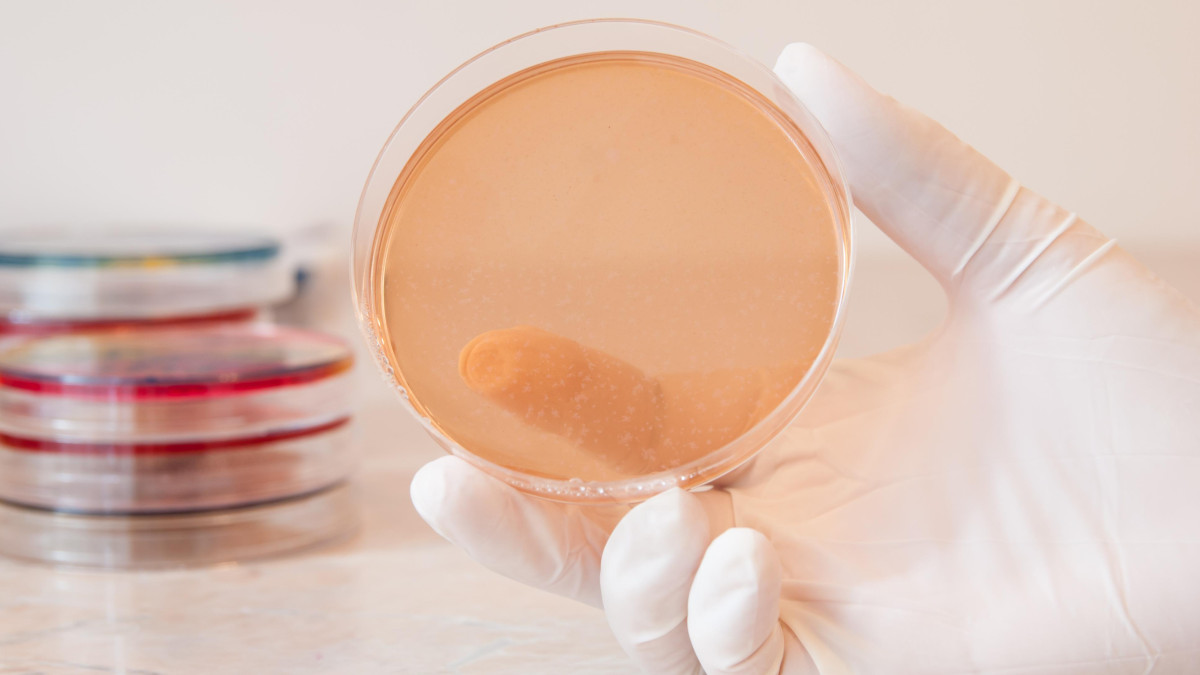 Salmonella zagrożeniem w Norwegii. Ogniska zakażeń w sześciu regionach