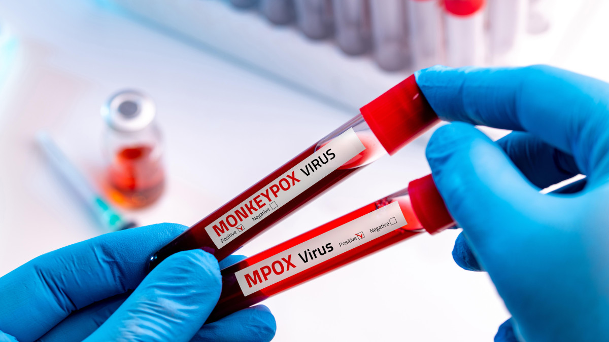 Małpia ospa w Oslo: w stolicy Norwegii odkryto nowe przypadki mpox