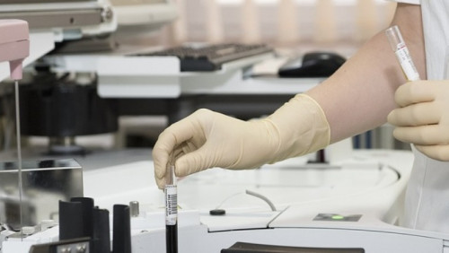 Badanie DNA i indywidualne leczenie dla każdego: Norwegowie mają nową broń w walce z rakiem