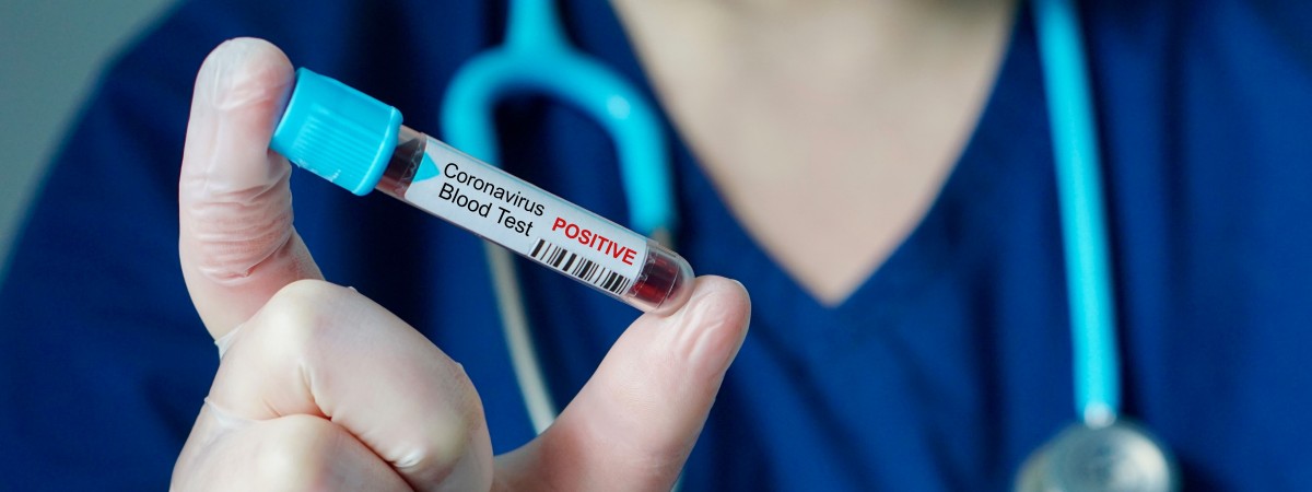 WHO nie powiedziało światu prawdy: globalne zagrożenie koronawirusem jest wysokie