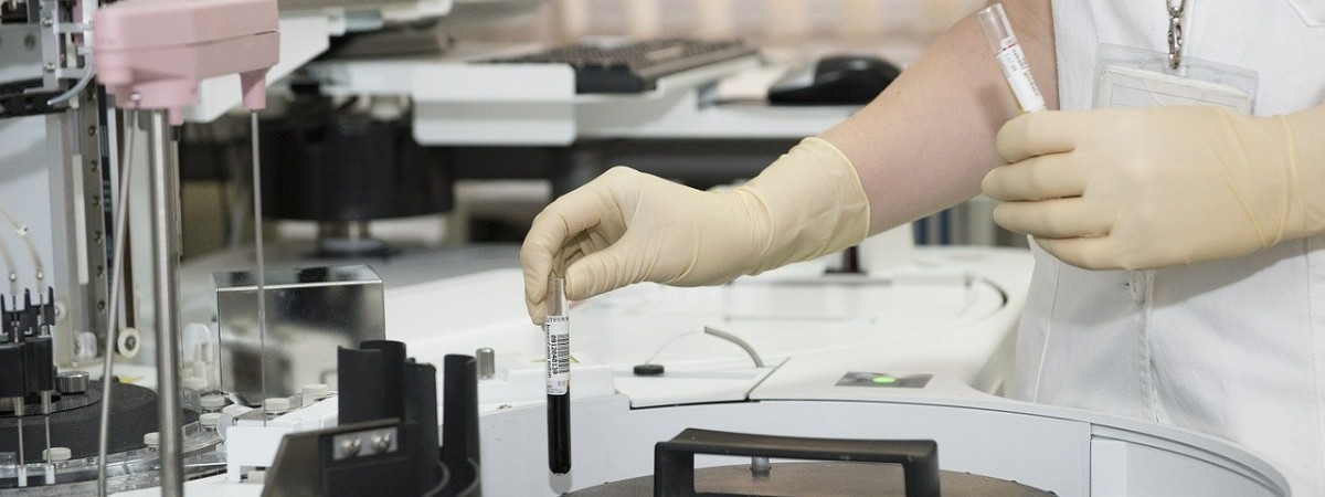 Nowy test na koronawirusa trafi do Norwegii: zwiększy wydajność kilkukrotnie