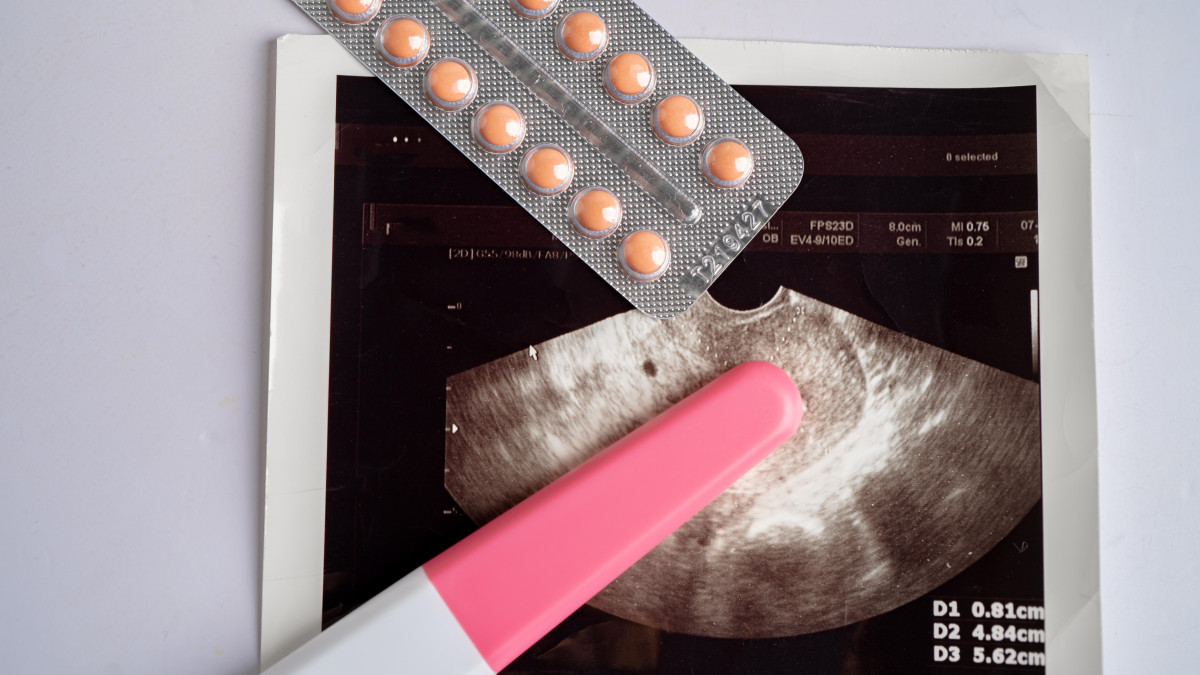 Długie kolejki do aborcji w Norwegii. Władze rozważają istotną zmianę