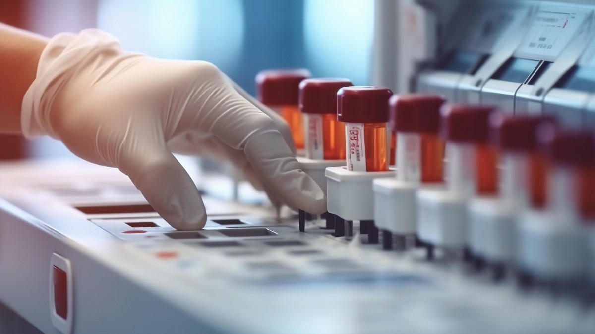 Chcą łatwiejszego dostępu do wyników badań w Norwegii. To z myślą o personelu medycznym i pacjentach