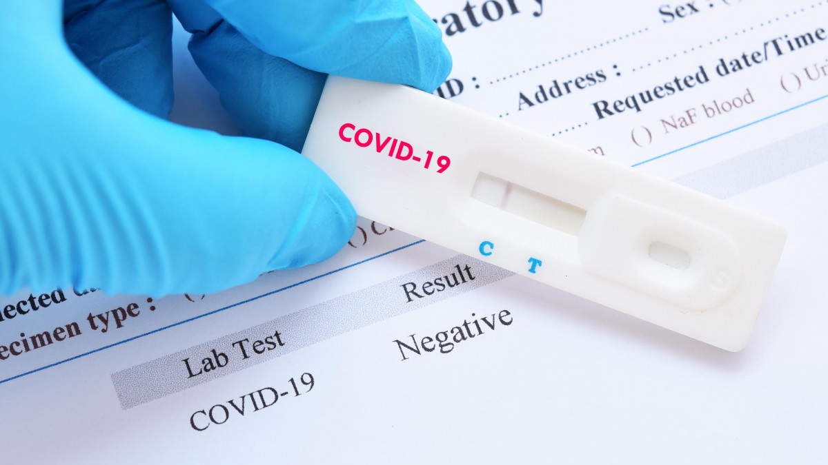 Na życzenie wydruk wyniku testu na koronawirusa. Zmiany w przepisach