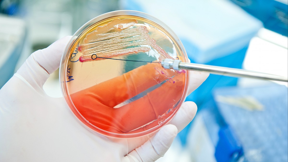 Nowe ognisko E. coli: źródło zakażenia na razie nieznane