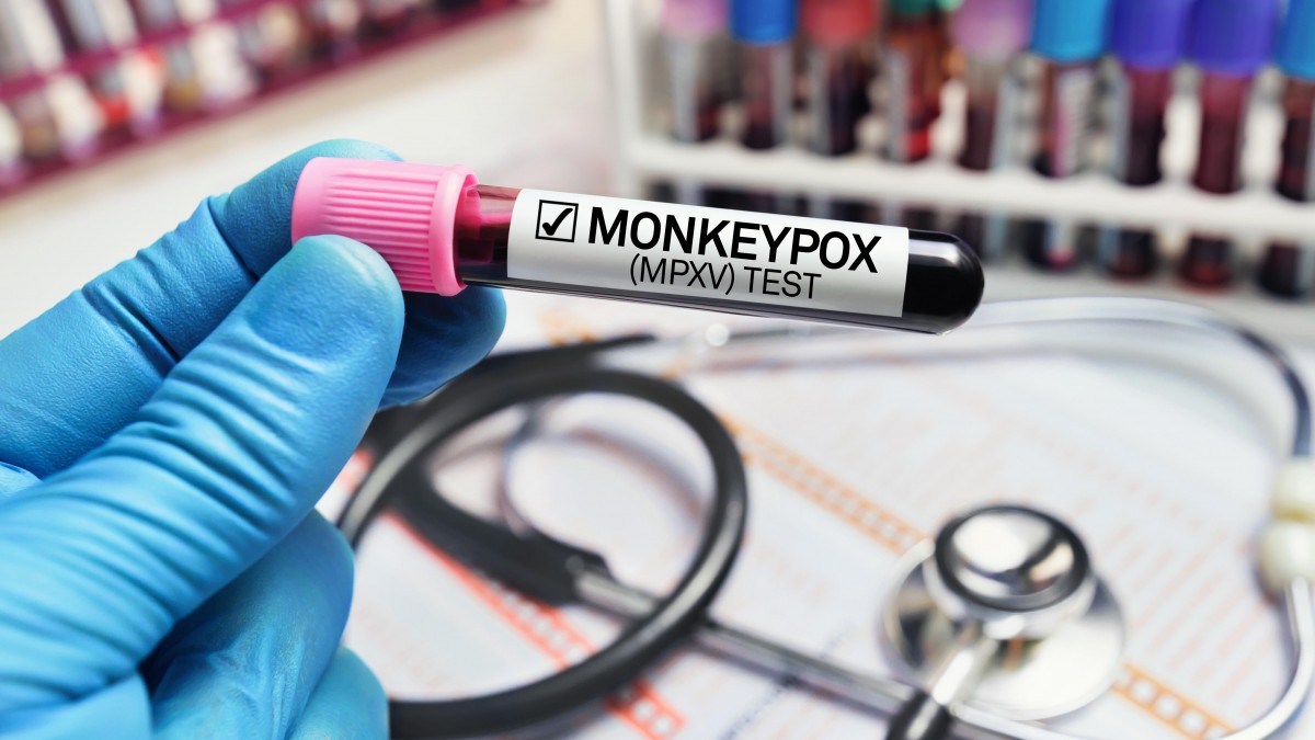 Norwegia kupi szczepionki przeciwko małpiej ospie. Dostawy w czerwcu