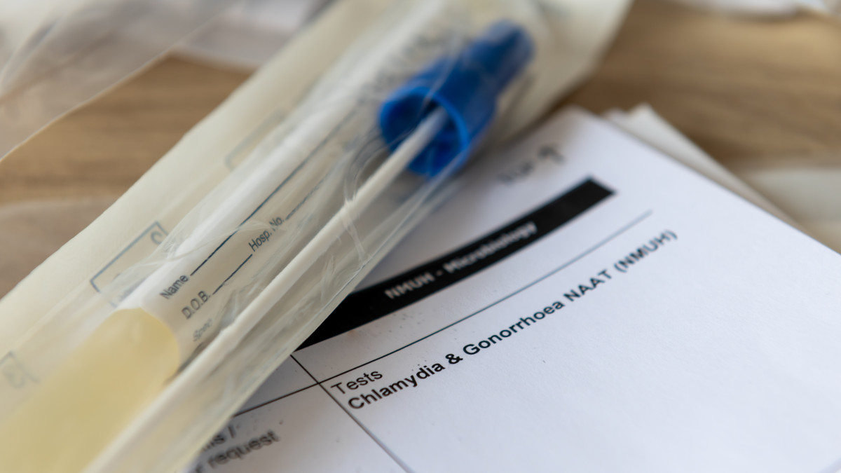 Tylu przypadków rzeżączki jeszcze nie zdiagnozowano: rekord zakażeń w Norwegii