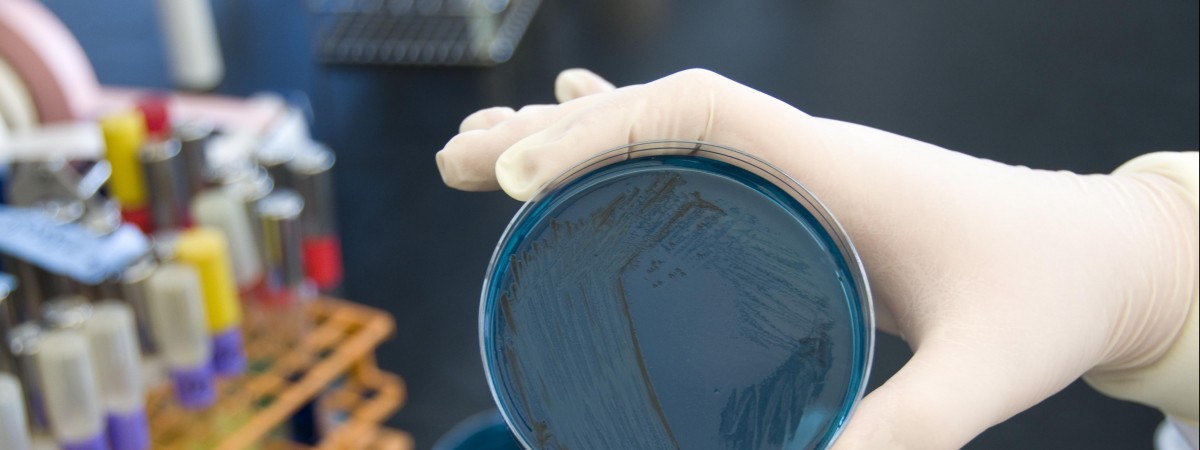 Liczba zarażonych salmonellą rośnie. Źródło bakterii wciąż jest nieznane