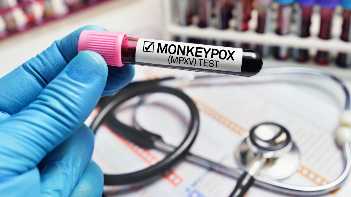 Małpia ospa chorobą niebezpieczną dla norweskiego społeczeństwa