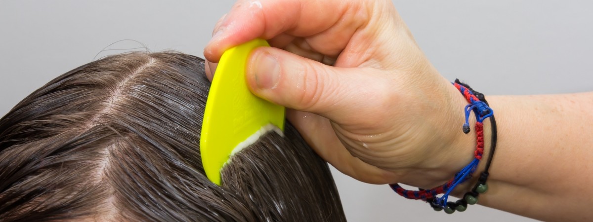 Wstydliwy problem Norwegów: Jesień to okres zmagań z wszami