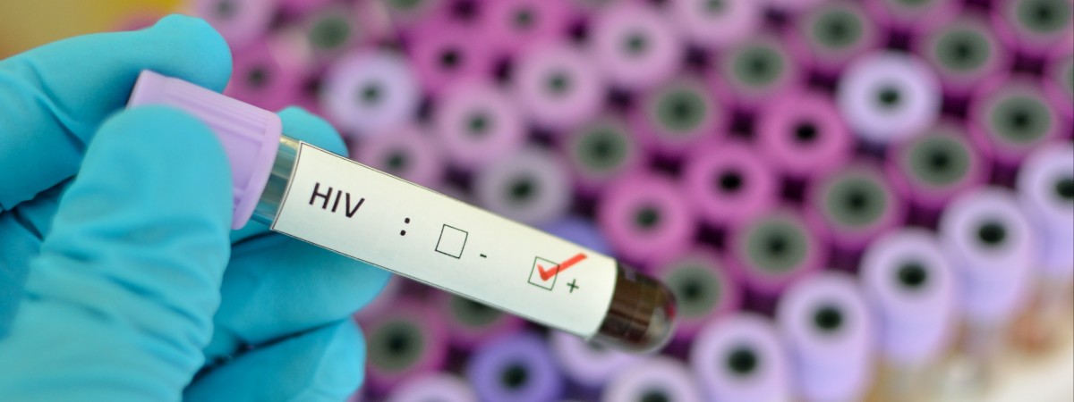 „Krok w kierunku uleczenia”: Norwegowie testują lek na HIV