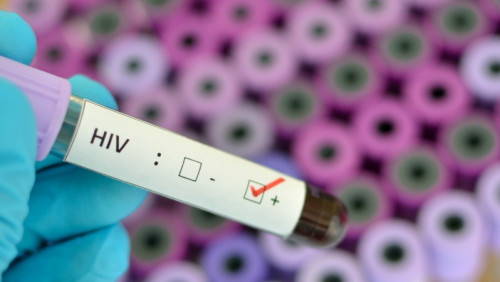 „Krok w kierunku uleczenia”: Norwegowie testują lek na HIV