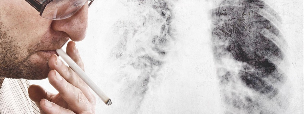 Norwegia wprowadzi jednolite opakowania papierosów