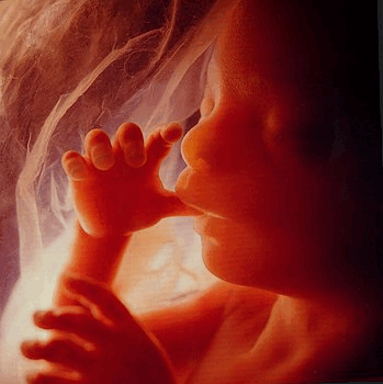 Høyre – wewnątrzpartyjny spór o ustawę aborcyjną 
