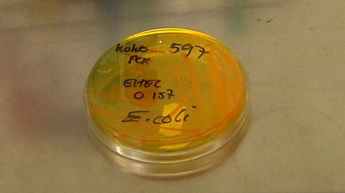 Uwaga ! Bakterie E-coli atakują