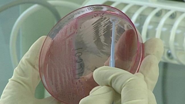 Najnowsze wyniki badań E-coli 