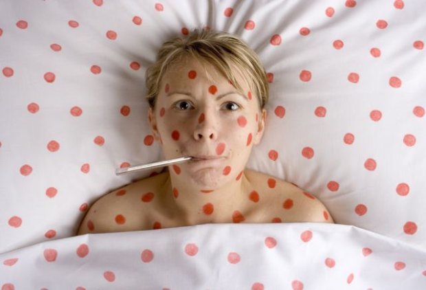 Epidemia różyczki w Polsce - norweski Instytut zdrowia publicznego zaleca szczepienia