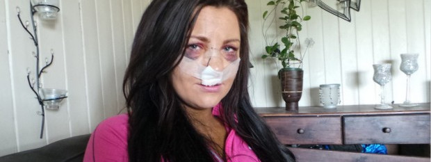 Polak oskarżony o brutalne pobicie i próbę gwałtu
