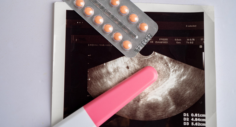 Długie kolejki do aborcji w Norwegii. Władze rozważają ważną zmianę