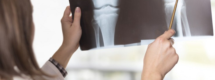 Zwrot kosztów leczenia po wypadku przy pracy