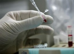 Wirus grypy A(H1N1) - mutuje