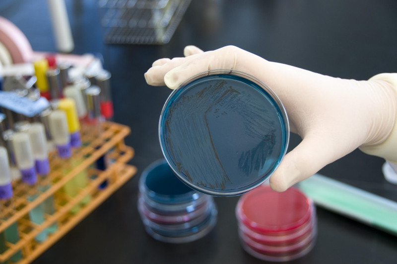 Wykryty wariant to Salmonella Napoli. W przeszłości zidentyfikowano go w Norwegii tylko jeden raz.
